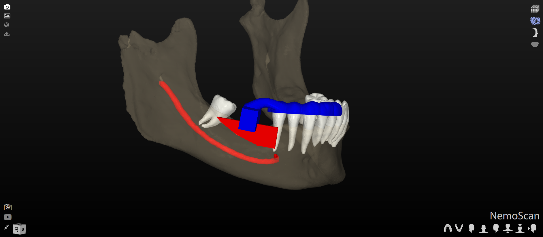 dental digital workflow