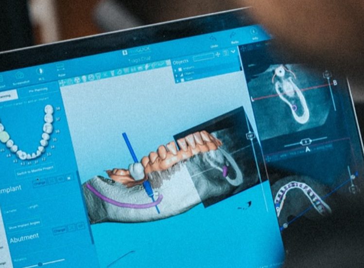 workflow-dental